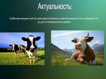 Субинволюция матки