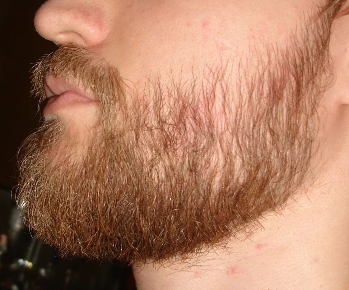 Миноксидил для бороды. Редкая борода. Рост бороды. Реденькая борода. Какие волосы на бороде