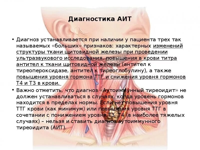 Аутоиммунный тиреоидит. Аутоиммунный тиреоидит щитовидной железы что это такое. Диагноз АИТ щитовидной железы что это.