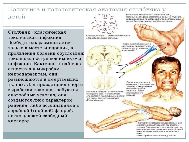 Что нельзя делать после столбняка. Столбняк очаги поражения. Схема заражения столбняком. Возбудитель столбняка симптомы. Столбняк пути симптомы.