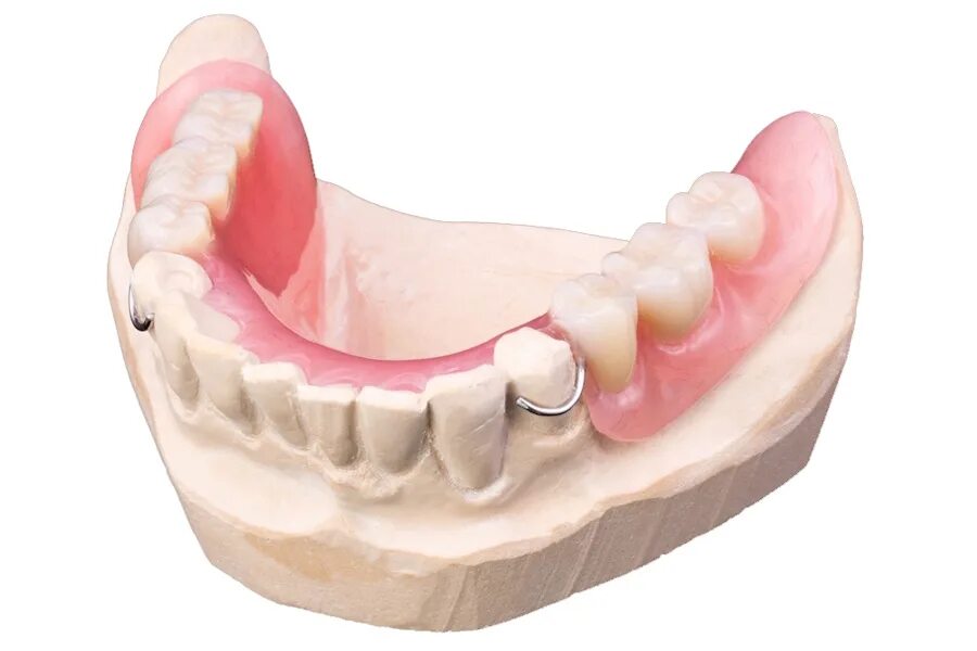 Съемный пластинчатый протез (1 пластина). Пластиночные зубные протезы на нижнюю челюсть. Частично съемным платиночный протез. Съемный пластиночный протез.