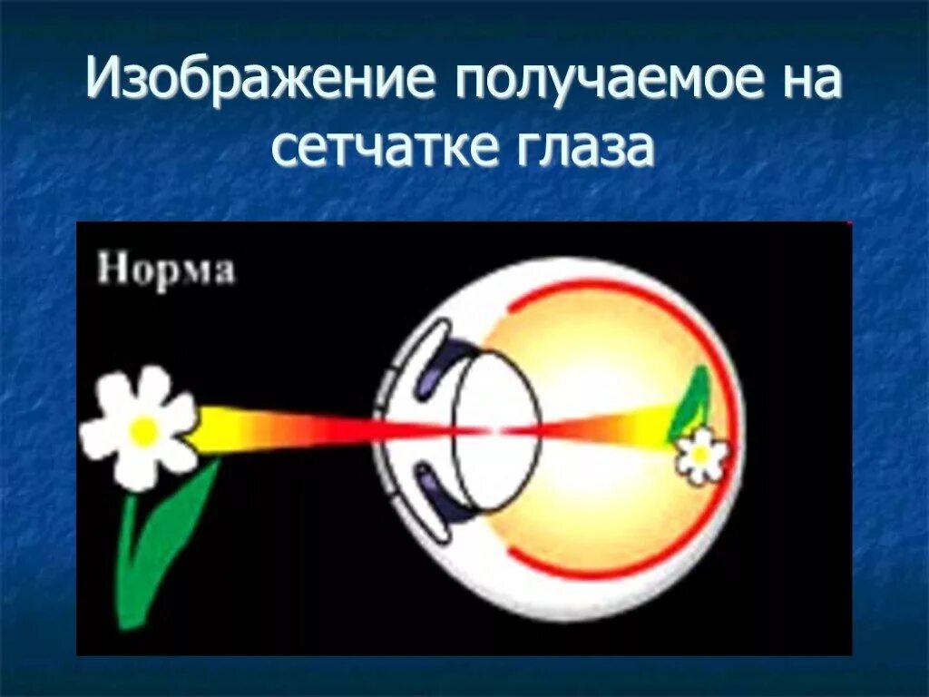 Изображение на сетчатке глаза. На сетчатке глаза изображение получается. Формирование изображения на сетчатке. Получили изображение с сетчатки.