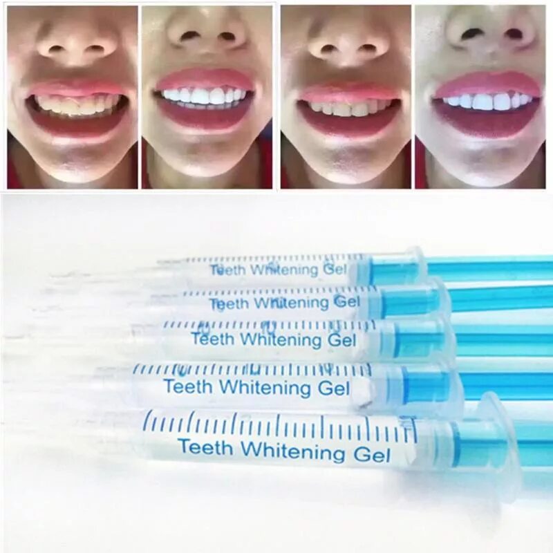 Отбеливание Опалесценс буст. Opalescence Boost система. Отбеливание зубов Teeth Whitening Kit. Отбеливание зубов Opalescence Boost. Отбеливание зубов отзывы цены