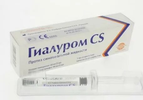 Артроз лечение гиалуроновой