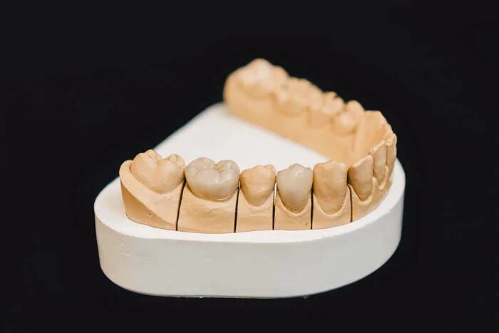Изготовление разборной модели. Гипсовая модель зуботехническая. Разборная модель. Разборная гипсовая модель. Штифтовая разборная модель.
