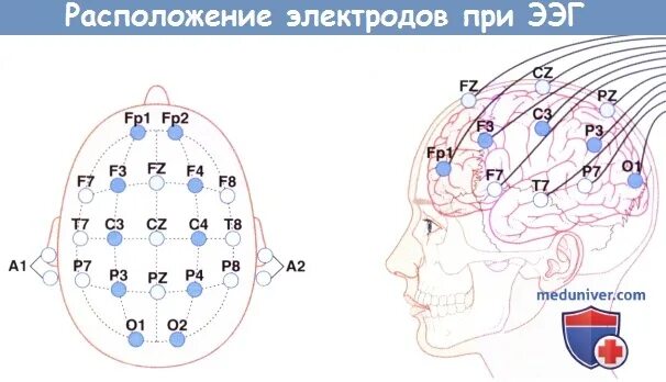 Система 10 20 это. Система 10 20 это