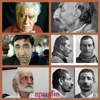 Отличия армян