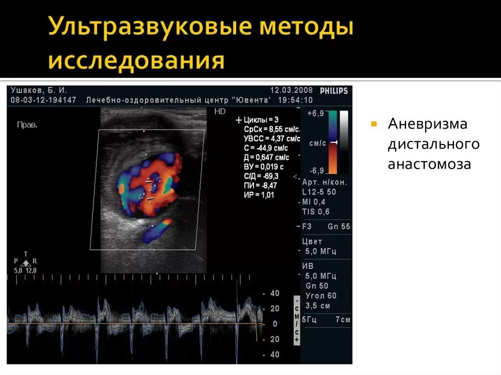 Методика к м н м. Ультразвуковая диагностика метод исследования. Способы ультразвукового исследования. М метод ультразвукового исследования. Одномерный метод ультразвукового исследования.