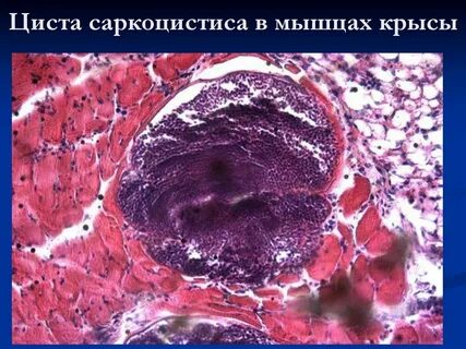 Саркоцисты