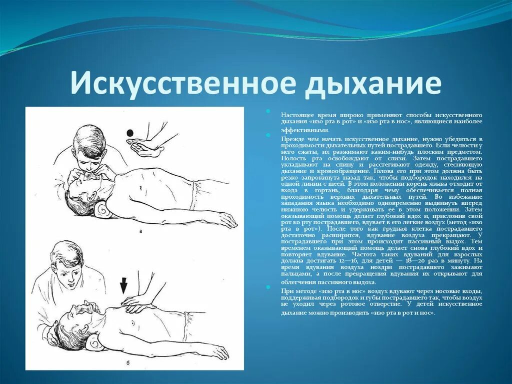 Искусственное дыхание проводится в случаях. Способы проведения искусственного дыхания. Искусственное дыхание методика выполнения. Схему выполнения искусственного дыхания..