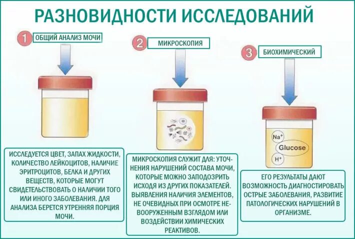 Почему утренняя моча. Средняя порция мочи. Исследование мочи. Порция мочи для анализа. Моча исследование.