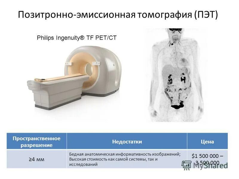 Пэт телефон. Позитронный эмиссионный томограф схема. ПЭТ механизм. Позитронно электронный томограф. ПЭТ-кт схема.