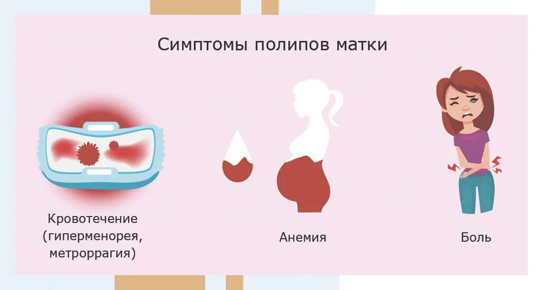 При полипе можно забеременеть. Симптомы полипа в матке кровотечения. Полип шейки матки кровотечения.