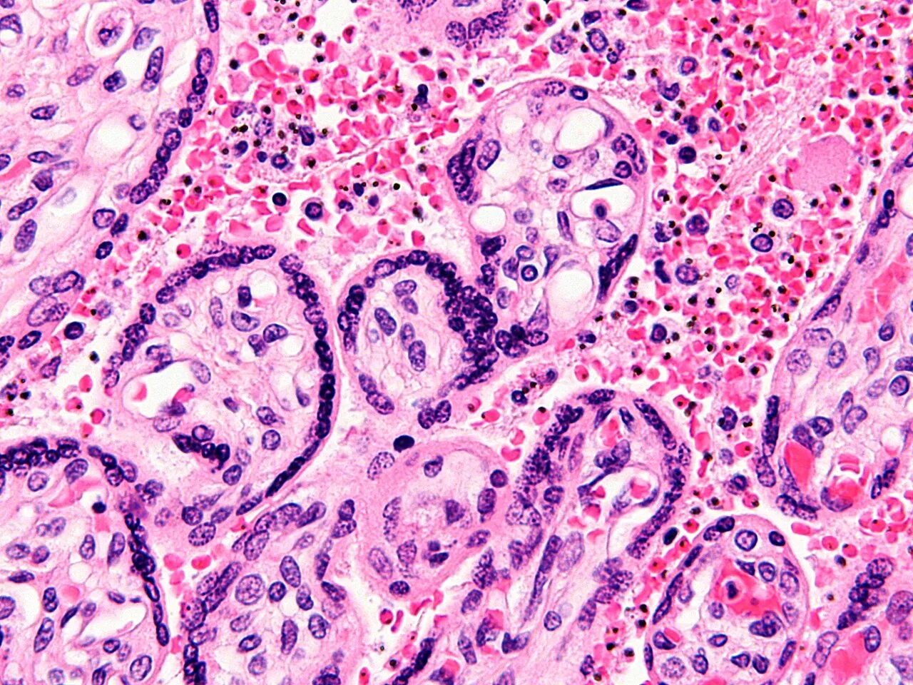 Клетки печени в крови. Plasmodium SP В селезенке. Малярийный плазмодий микропрепарат. Малярийная пигментация селезенки микропрепарат. Малярийный плазмодий гепатоциты.