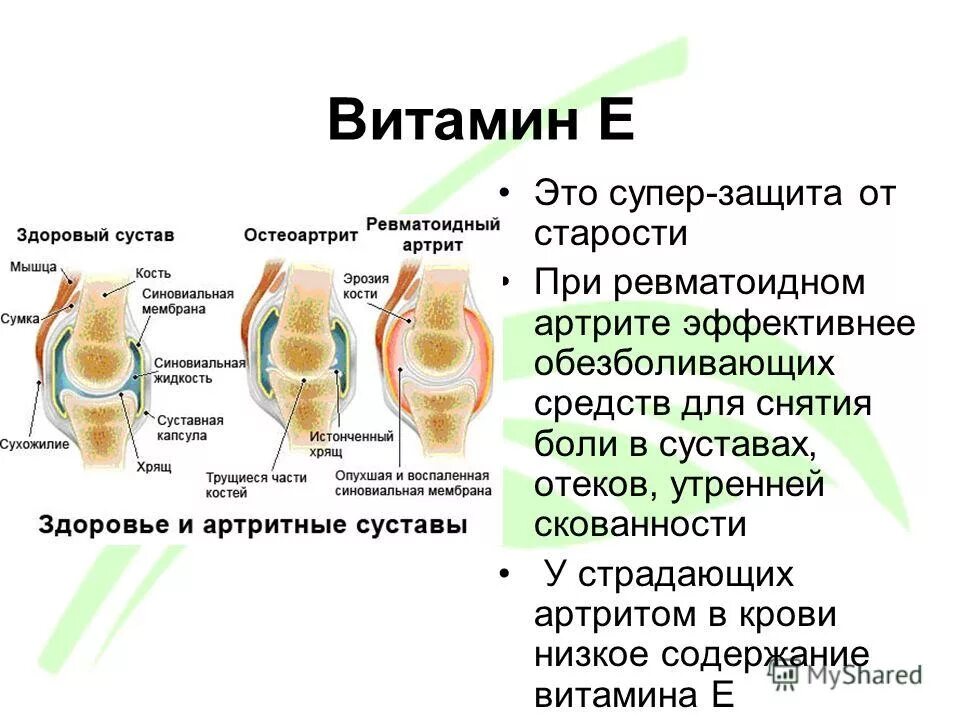 Боль в суставах какие витамины