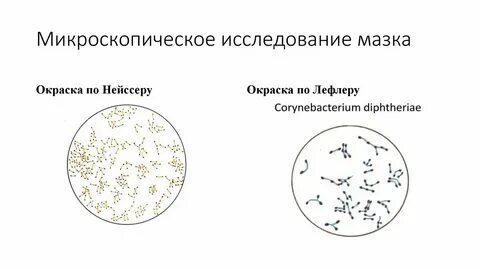 Микроскопия у женщин