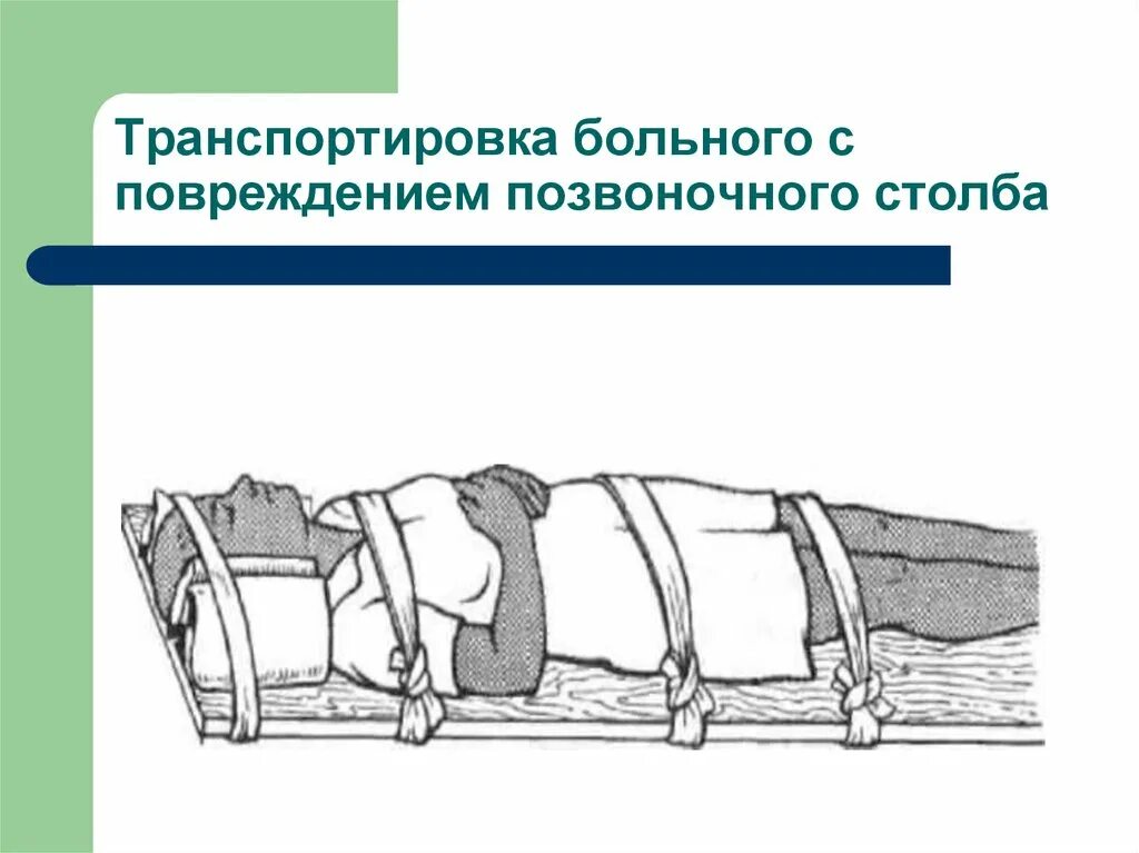 При повреждении позвоночника транспортируют. Травма позвоночника транспортировка. Транспортировка больного с переломом. Транспортировка при повреждении позвоночника. Перелом позвоночника транспортировка.