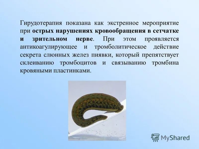 Гирудотерапия показания. Слюнные железы пиявок содержат. Пиявки на поджелудочную железу схема. Представители пиявок кольчатых червей. Тип кольчатые черви пиявки строение.