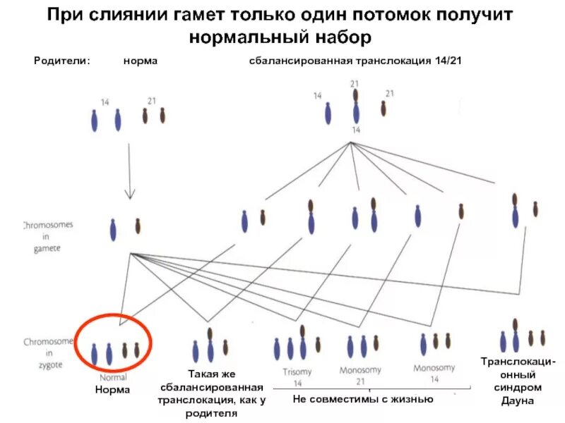 21 генотип. Наследование робертсоновской транслокации. Сбалансированная транслокация. Наследование синдрома Дауна схема. Механизм образования аномальных гамет у человека.