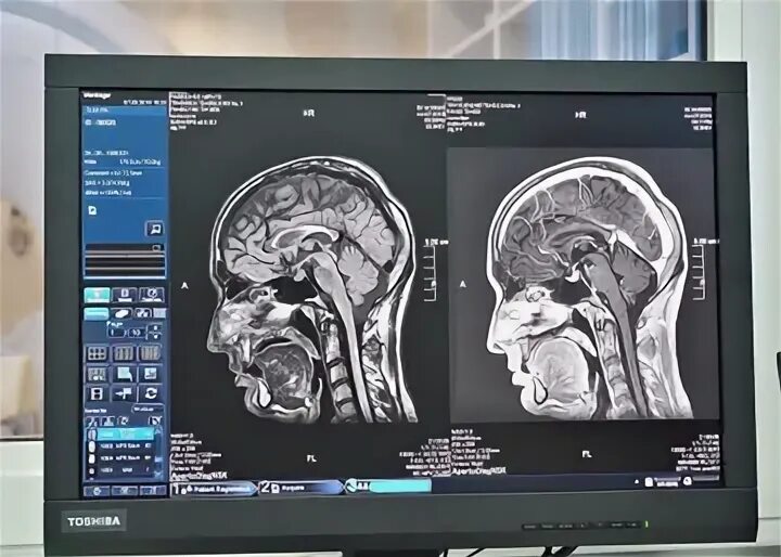 Мрт мозга ульяновске цены. Мрт головы. Томография головы. Мрт Аперто.