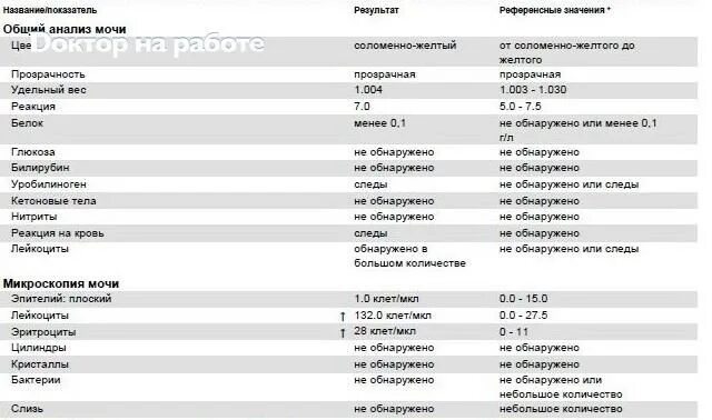 Моча кл мкл