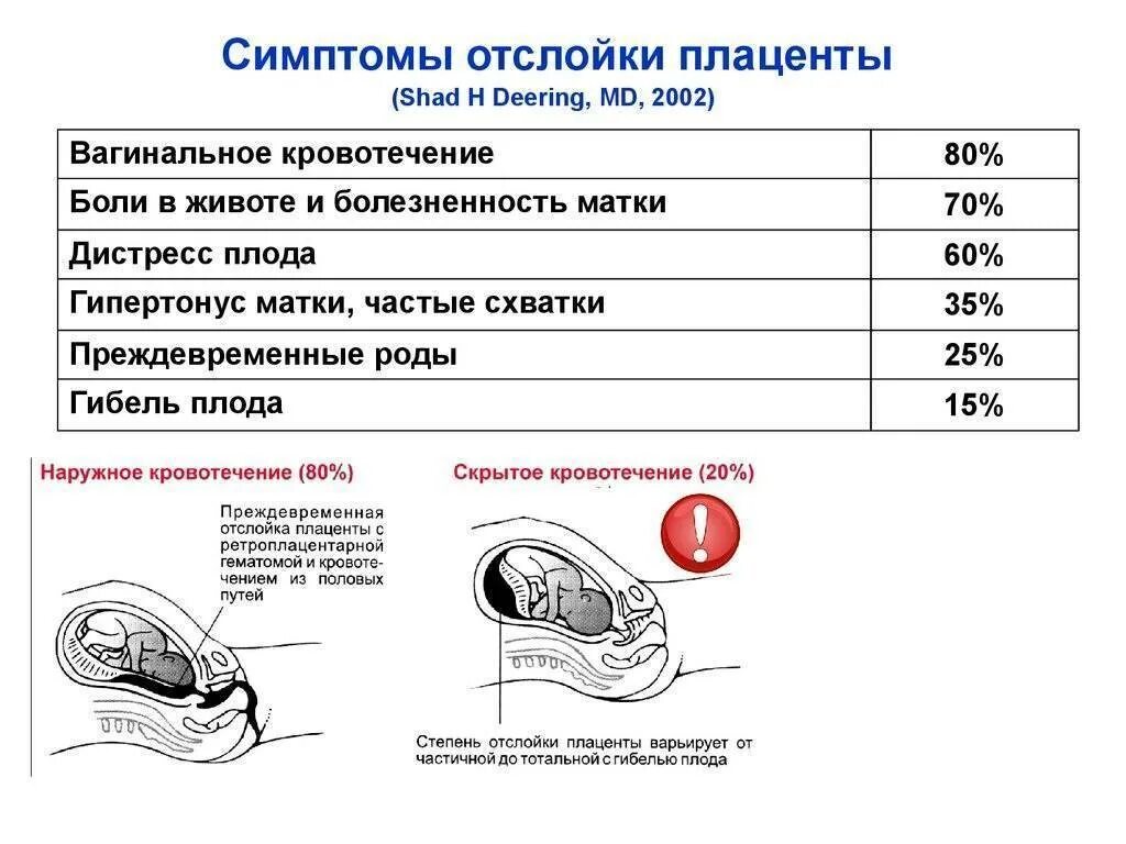 Отслойка плаценты симптомы. Отслойка плаценты на ранних сроках. Сохранение плода беременности