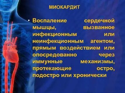 Воспаление сердца