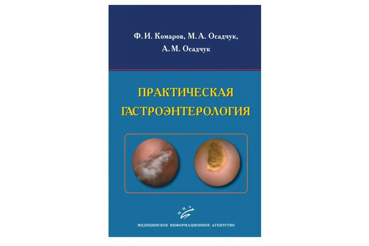 Гастроэнтерология национальное руководство. Практическая гастроэнтерология. Практическая гастроэнтерология Ахмедов. Справочник по гастроэнтерологии. Клиническая гастроэнтерология.