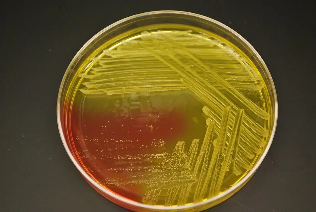 Staphylococcus aureus среда