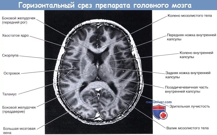 Доли мозга мрт. Строение головного мозга аксиальный срез. Мрт головного мозга поперечный срез. Мрт анатомия головного мозга аксиальные срезы. Доли головного мозга мрт анатомия.