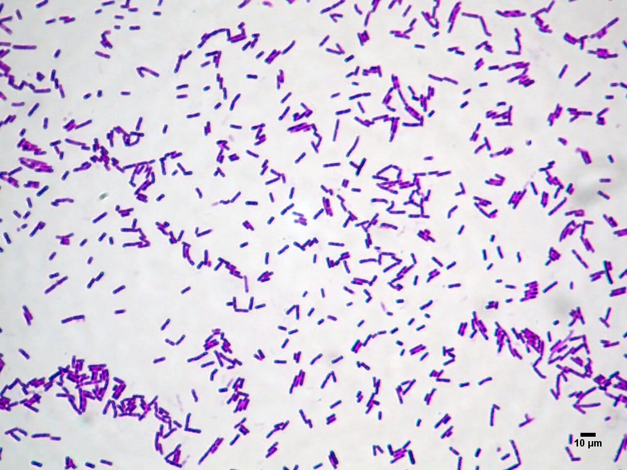 Микроорганизмы образующие споры. Bacillus subtilis (Сенная палочка). Микропрепарат бактерии Сенной палочки. Палочка цереус (Bacillus Cereus). Bacillus subtilis грамположительные.