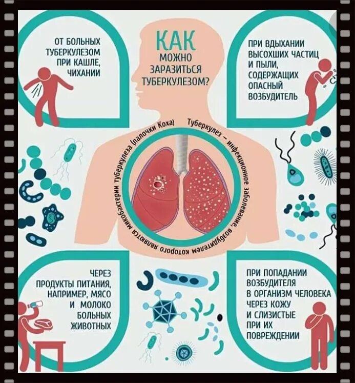 Туберкулез конспект