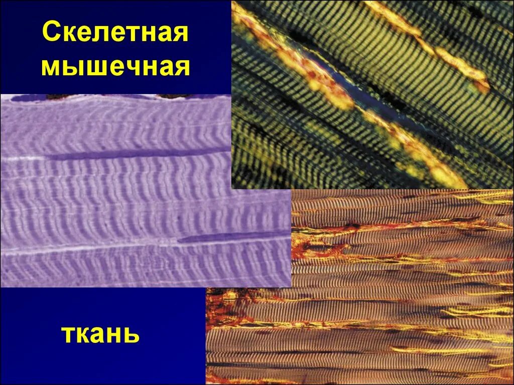 Волокна скелетных мышц под микроскопом Мышечная ткань под микроскопом Мышечная ткань под микроскопом Пикабу