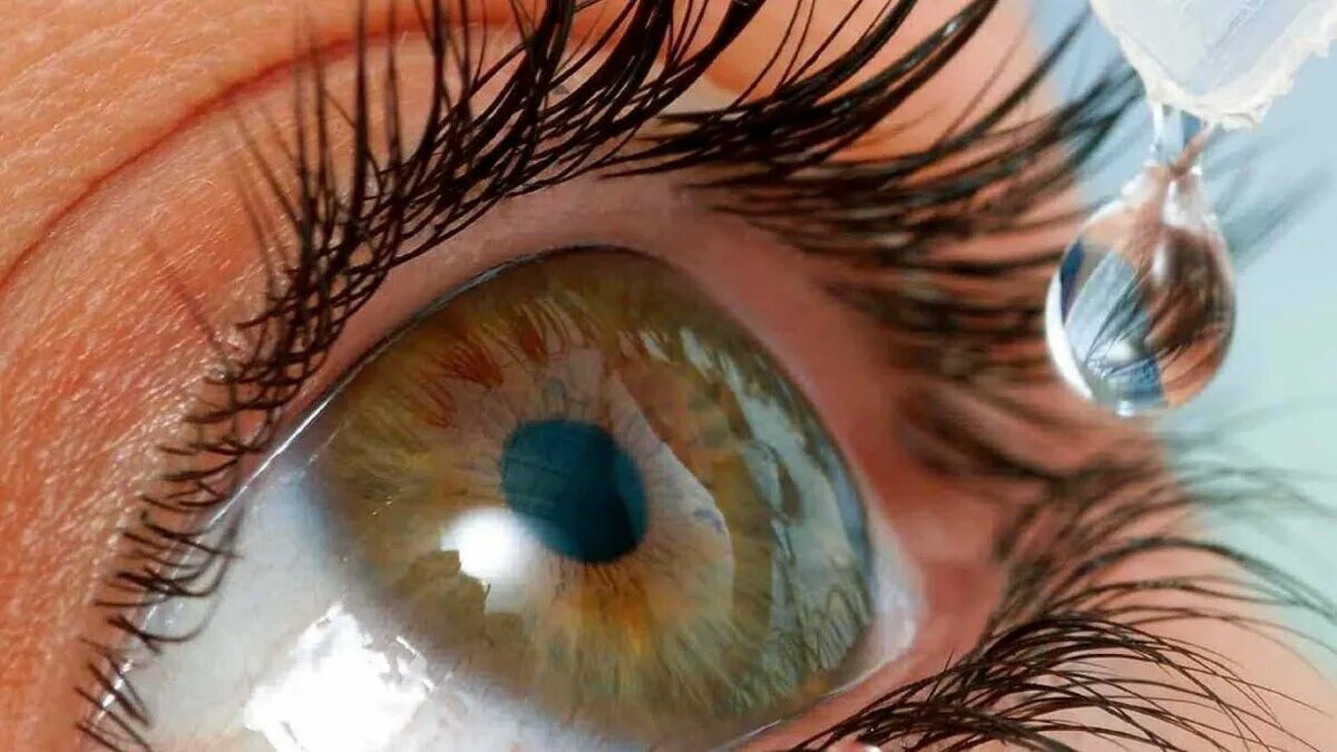 В глазу как будто капля. Фликтенулезный кератит. Субконъюнктивальное кровоизлияние. Эписклерит конъюнктивит. Инородное тело в глазу капли.