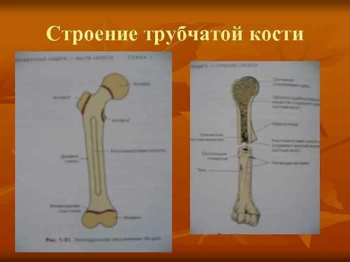 Строение трубчатой кости эпифиз диафиз. Строение эпифиза трубчатой кости. Схема строения длинной трубчатой кости. Метафиз бедренной кости.