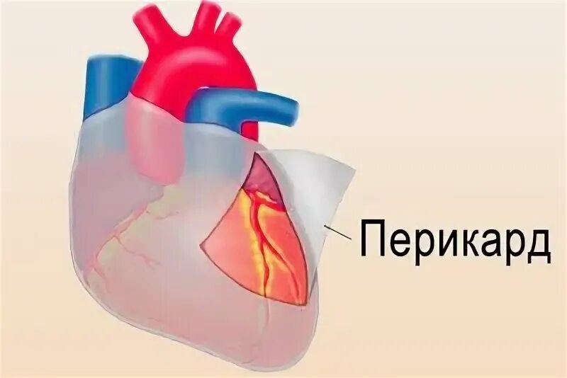 Строение околосердечной сумки. Перикард сердца анатомия. Строение перикарда сердца. Перикард (околосердечная сумка). Экссудативный перикардит границы сердца.