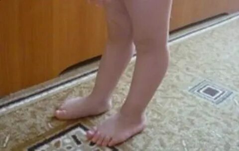 Колени назад