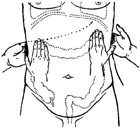 Пальпация сигмовидной кишки. Пальпация Толстого кишечника схема. Поверхностная пальпация кишечника. Пальпация кишечника сигмовидная. Массаж снизу вверх
