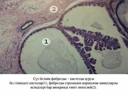 Хардкор оргия топтық секс