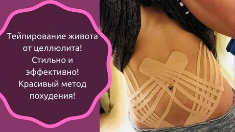 Тейпирование убираем живот