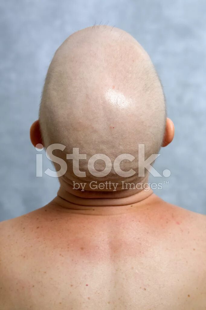 Forced head
