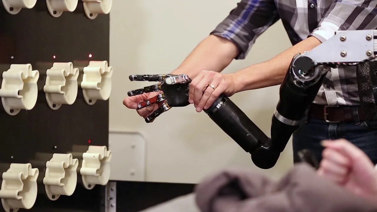 Искусственная рука. Гибкая роботизированная рука. Искусственная рука робота. Роботизированная рука ортопедия.