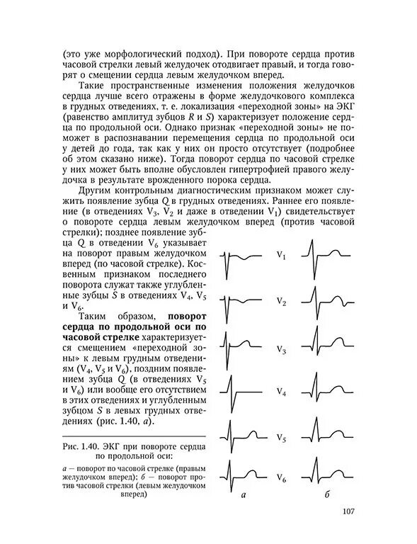 Поворот вокруг продольной оси ЭКГ. Повороты сердца вокруг оси на ЭКГ. Повороты сердца на ЭКГ вокруг продольной оси. Поворот сердца вокруг продольной оси. Поворот правым желудочком вперед