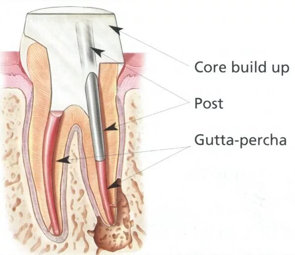 Core posting