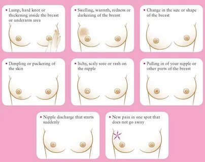 Download "Breast Cancer Information" in high resolution for free....