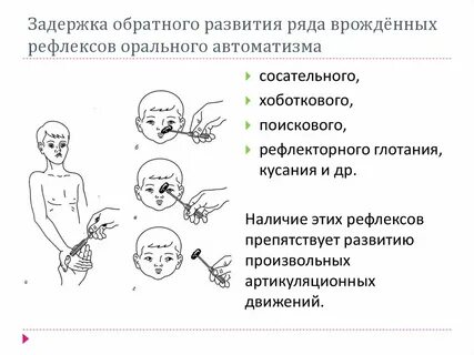 Проявление автоматизма