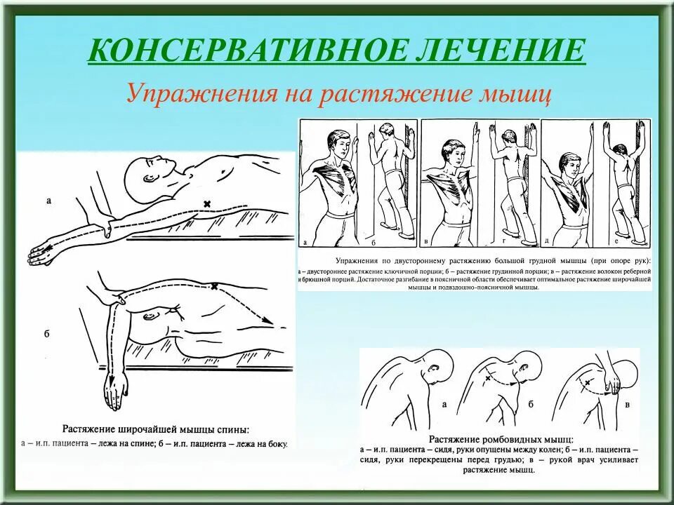 Лечение частичного разрыва мышц. Симптомы растяжения мышц. Растяжение мышц лечение.