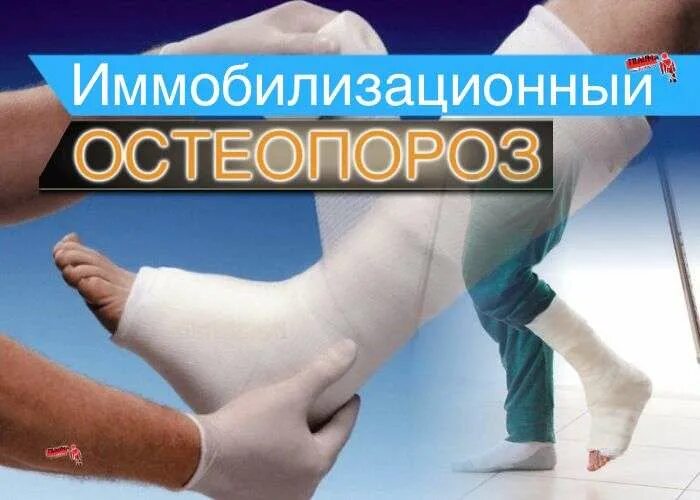 Проявления остеопороза. Пятнистый регионарный остеопороз. Диффузный остеопороз костей рентген. Пяточная кость таранная кость. Иммобилизационный остеопороз.