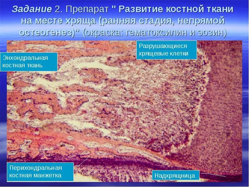 Препарат костной ткани. Гистогенез костной ткани препарат. Пластинчатая костная ткань гистология. Грубоволокнистая костная ткань препарат гистология. Прямой остеогистогенез препарат гистология.
