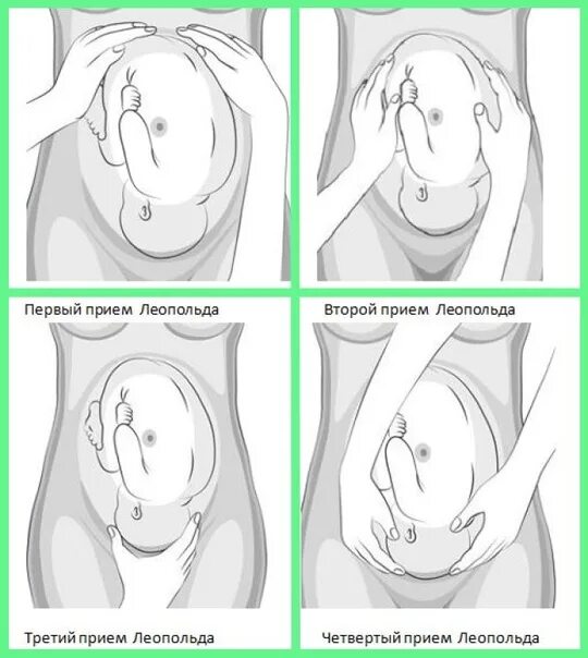 Приемы леопольда алгоритм. 4 Приема Леопольда Левицкого в акушерстве. Четвертый прием Леопольда Левицкого. Приемы Леопольда Левицкого 1 прием. Приём Леопольда-Левицкого в акушерстве 2.